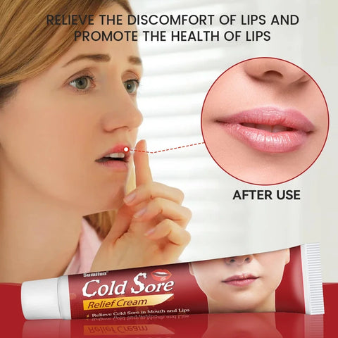 Sumifun Cheilitis Treatment Cream - Effective Relief for Lip Inflammation