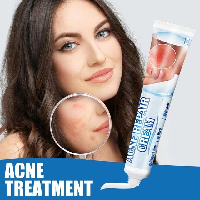 Sumifun Acne Treatment Cream - Clear & Smooth Skin Solution