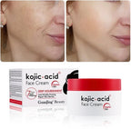 Kojic Acid Dark Spot Lightening Cream  50g - Fade Dark Spots & Even Skin Tone