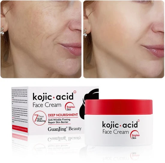 Kojic Acid Dark Spot Lightening Cream  50g - Fade Dark Spots & Even Skin Tone