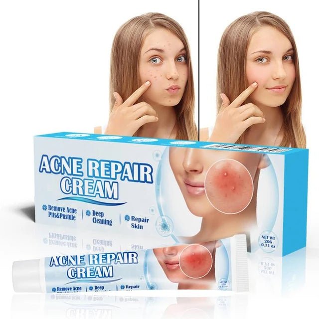 Sumifun Acne Treatment Cream - Clear & Smooth Skin Solution