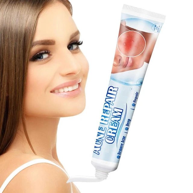Sumifun Acne Treatment Cream - Clear & Smooth Skin Solution