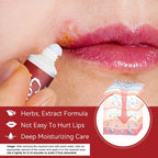 Sumifun Cheilitis Treatment Cream - Effective Relief for Lip Inflammation