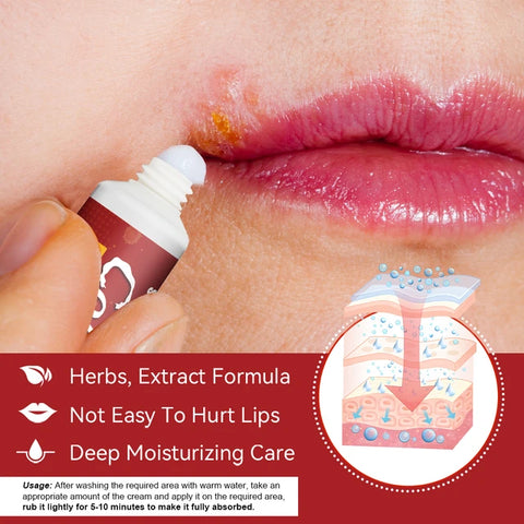 Sumifun Cheilitis Treatment Cream - Effective Relief for Lip Inflammation