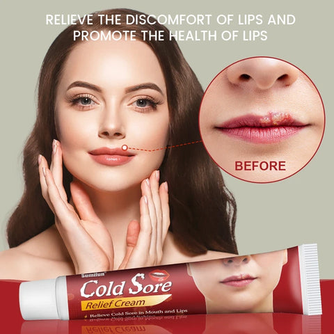 Sumifun Cheilitis Treatment Cream - Effective Relief for Lip Inflammation