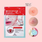 AC Mild Red Spot Patch - Fast-Acting Acne Spot Treatment