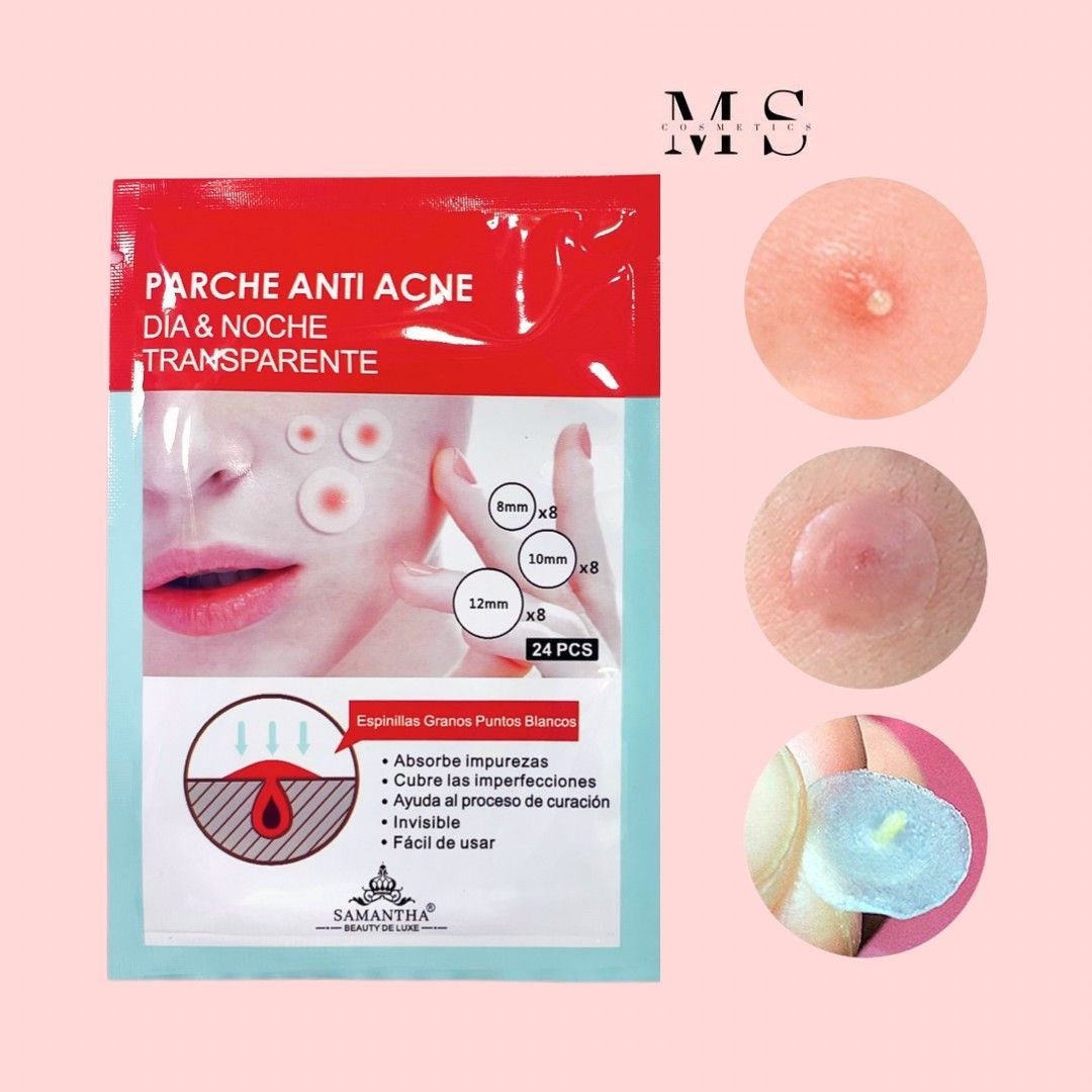 AC Mild Red Spot Patch - Fast-Acting Acne Spot Treatment
