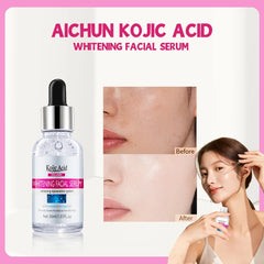 Kojic Acid Whitening Serum - Brightening & Skin Tone Evenness