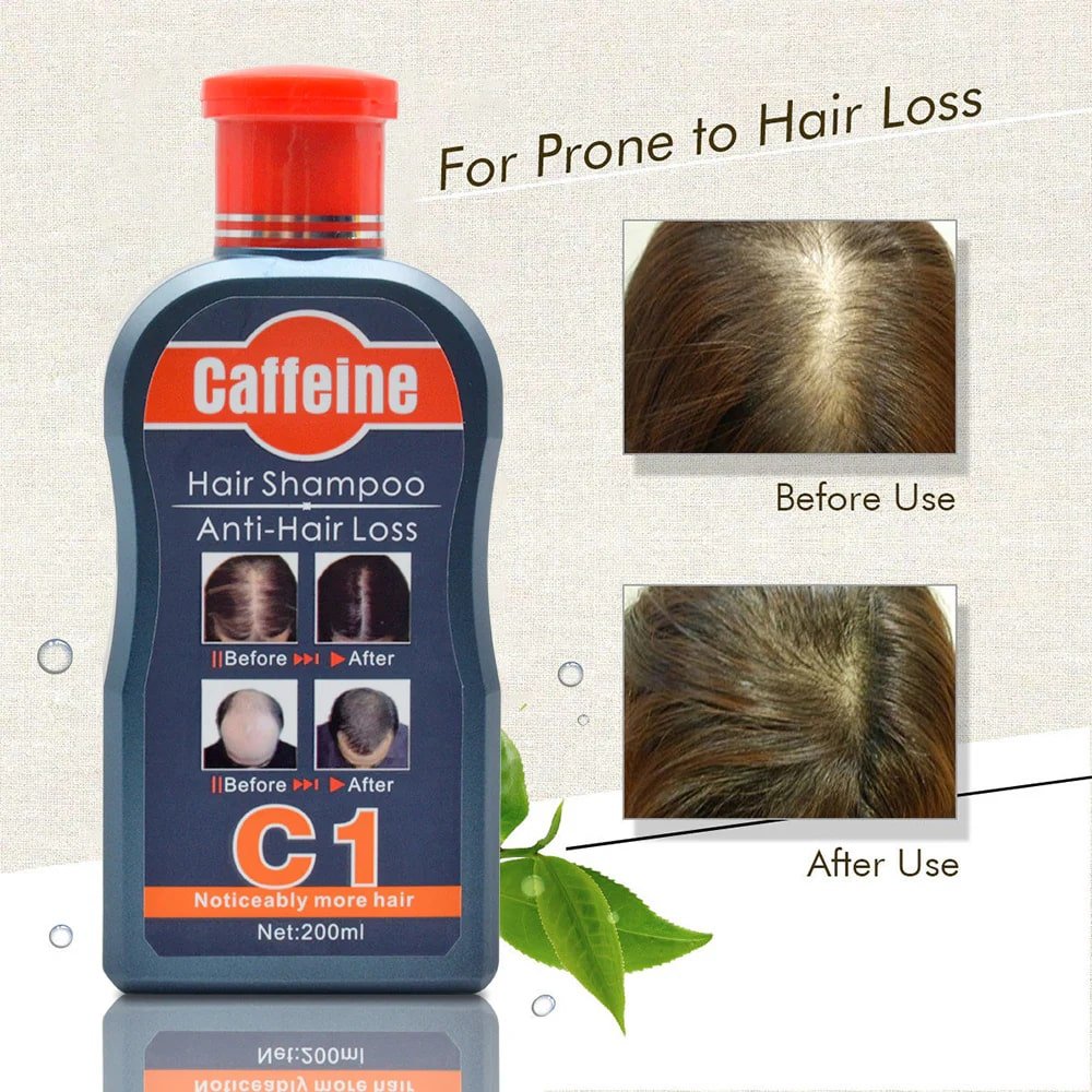 Hair Growth Essence Anti Hair Loss Essential Oil Shampoo 200ml