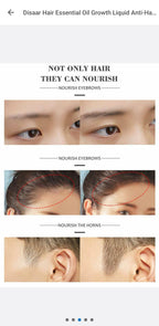 Disaar Hair Essential Oil Anti-Hair Loss