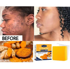 GuanJing Tumeric Facial Soap 100g